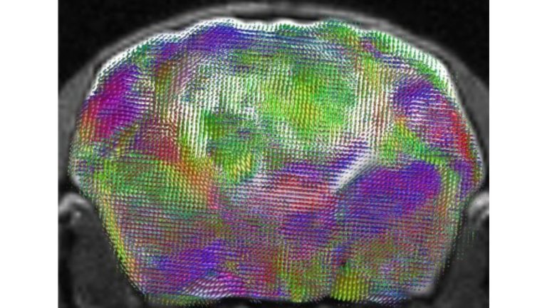 Stanford mice now grow a human cortex in their heads